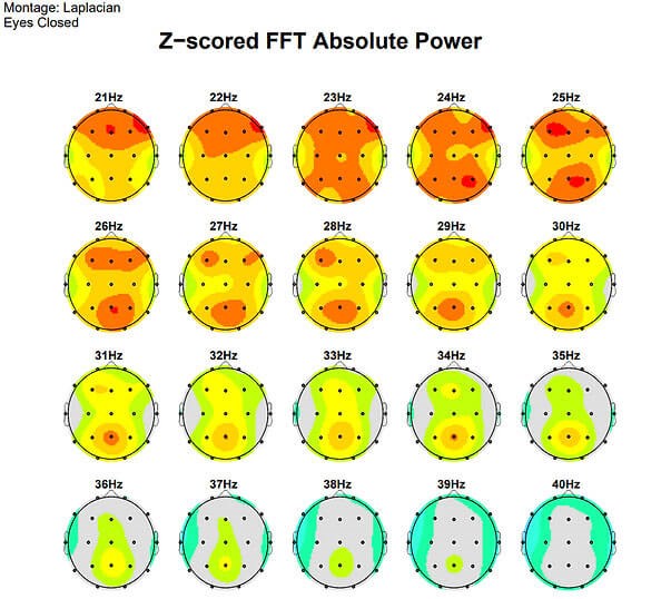 Session 25 — same patient, after training