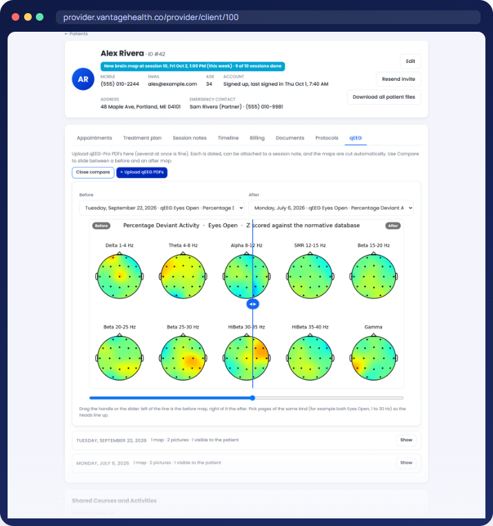 A Vantage Health patient folder comparing qEEG brain maps before and after treatment